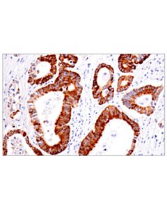Cell Signaling AMACR (F7T6V) Rabbit mAb 100 uL