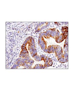 Cell Signaling Bim (C34c5) Rabbit mAb