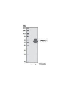 Cell Signaling Tp/Ecgf1 Antibody