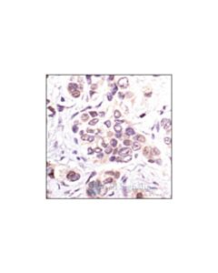 Cell Signaling P21 Waf1/Cip1 (Dcs60) Mouse mAb