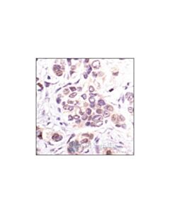 Cell Signaling P21 Waf1/Cip1 (Dcs60) Mouse mAb