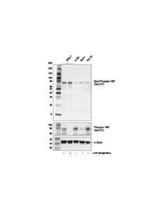 Cell Signaling Non-phospho (Active) YAP (Ser127) (E6U8Z) Rabbit mAb 20 uL