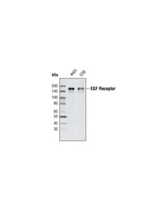 Cell Signaling Egf Receptor (T43) Antibody