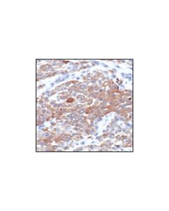 Cell Signaling Phospho-Mtor (Ser2448) (49f9) Rabbit mAb (Ihc Specific)