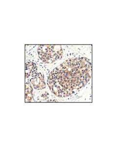 Cell Signaling Mtor (7c10) Rabbit mAb