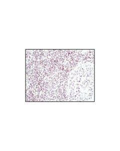Cell Signaling Lck (D88) Xp Rabbit mAb