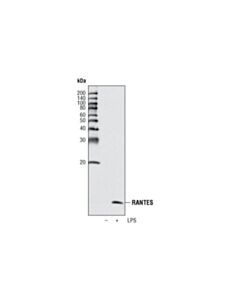 Cell Signaling Ccl5/Rantes (R40) Antibody