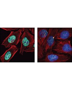 Cell Signaling Set8 (C18b7) Rabbit mAb