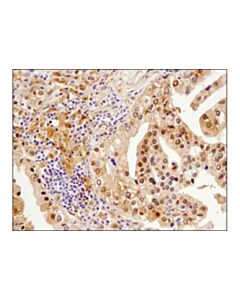 Cell Signaling Beta-Arrestin 1 (D7z3w) Xp Rabbit mAb