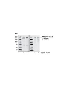 Cell Signaling Insulin Receptor Substrate Antibody Sampler Kit