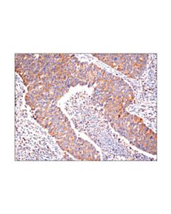 Cell Signaling Nf-Kappab2 P100/P52 (18d10) Rabbit mAb