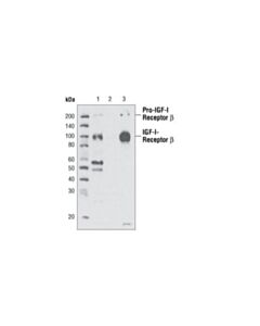 Cell Signaling Igf-I Receptor Beta (111a9) Rabbit mAb