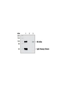 Cell Signaling Insulin Receptor Beta (4b8) Rabbit mAb