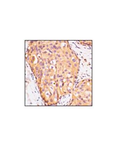 Cell Signaling Igf-I Receptor Beta Antibody