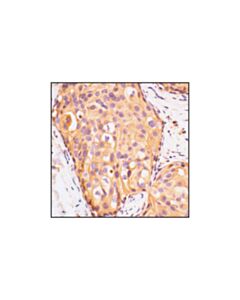 Cell Signaling Igf-I Receptor Beta Antibody