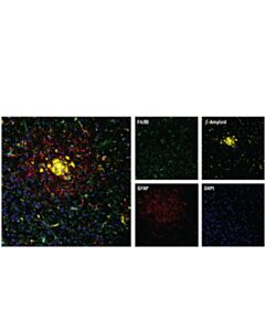 Cell Signaling F4/80 (D4c8v) Xp Rabbit mAb