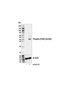 Cell Signaling Phospho-Sting (Ser366) (E9a9k) Rabbit mAb (Biotinylated)