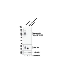 Cell Signaling Phospho-Tau Ser202/Thr205 (E6s2w) Rabbit mAb
