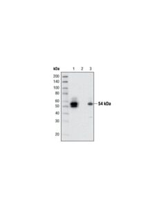 Cell Signaling Lkb1 (27d10) Rabbit mAb