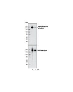 Cell Signaling Phospho-Egf Receptor (Thr669) Antibody