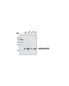 Cell Signaling Hspb8/Hsp22 Antibody