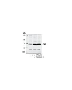 Cell Signaling Pkr Antibody