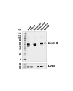 Cell Signaling Keratin 14 (E7j5w) Rabbit mAb