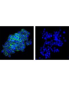 Cell Signaling C-Kit (D13a2) Xp Rabbit mAb