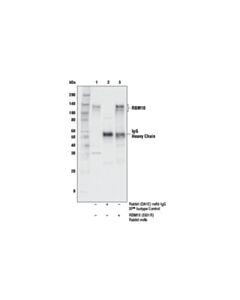 Cell Signaling Rbm10 (E6i1r) Rabbit mAb