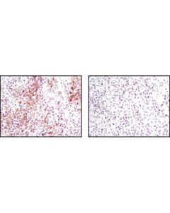 Cell Signaling Phospho-Met (Tyr1234/1235) (D26) Xp Rabbit mAb