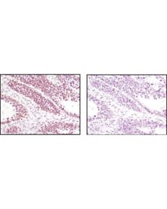 Cell Signaling Jmjd1b (C6d12) Rabbit mAb
