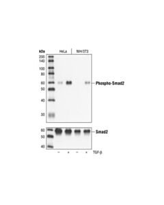 Cell Signaling Phospho-Smad2 (Ser465/467) (138d4) Rabbit mAb