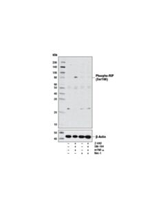 Cell Signaling Phospho-Rip (Ser166) Antibody (Rodent Specific) Apply) (Additional