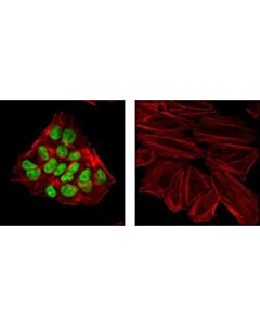 Cell Signaling Hnf4alpha (C11f12) Rabbit mAb