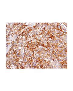 Cell Signaling Pvr/Cd155 (D8a5g) Rabbit mAb (BSA And Azide Free)