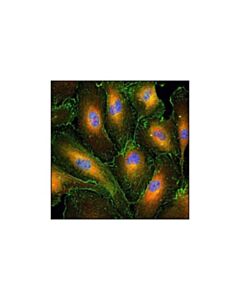 Cell Signaling Vasp (9a2) Rabbit mAb