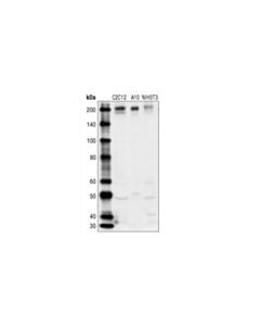 Cell Signaling Pdgf Receptor Beta Antibody