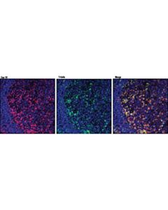 Cell Signaling Zap-70 (D1c10e) Xp Rabbit mAb