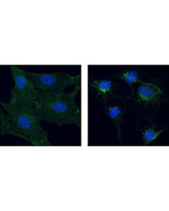 Cell Signaling Pdgf Receptor Beta (28e1) Rabbit mAb