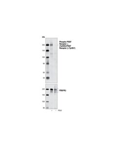 Cell Signaling Phospho-Pdgf Receptor Alpha (Tyr849)/Pdgf Receptor Beta (Tyr857) (C43e9) Rabbit mAb