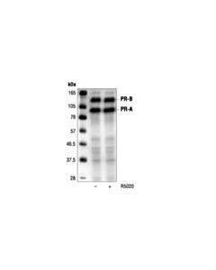 Cell Signaling Progesterone Receptor (6A1) Mouse mAb 20 uL