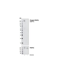 Cell Signaling Phospho-Pdgf Receptor Beta (Tyr771) (76d6) Rabbit mAb