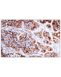 Cell Signaling Daf/Cd55 (E7g2u) Xp Rabbit mAb