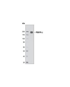 Cell Signaling PDGF Receptor beta (2B3) Mouse mAb 20 uL