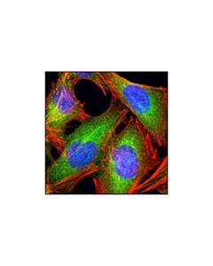 Cell Signaling Fatty Acid Synthase (C20g5) Rabbit mAb