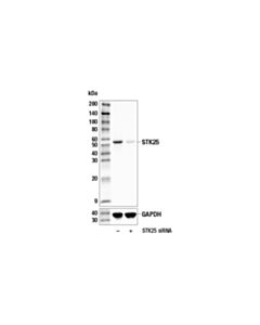 Cell Signaling Stk25 (E7t2f) Rabbit mAb