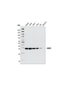 Cell Signaling NQO1 (A180) Mouse mAb 20 uL