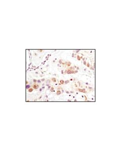 Cell Signaling Pyruvate Dehydrogenase (C54g1) Rabbit mAb