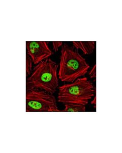 Cell Signaling Ap-2alpha (C83e10) Rabbit mAb