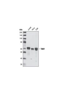 Cell Signaling Tab1 (C25e9) Rabbit mAb
